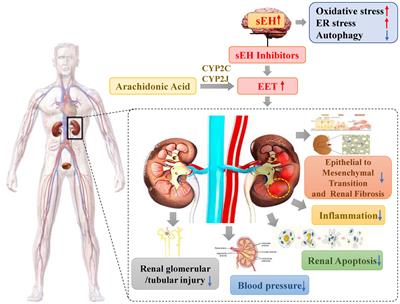 Regulation of soluble epoxide hydrolase in renal-associated diseases: insights from potential mechanisms to clinical researches